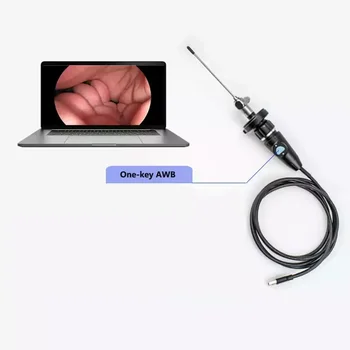 Медицинская портативная USB-эндоскопическая камера Full HD CMOS для ЛОР-назального отоскопа, ушной лапароскопической гинекологии